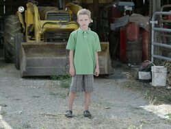 Slow motion of boy with cleft lip standing in front of tractor. Stock Footage
