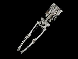 Multiâ€“Detector CT Angiography of Lower Extremity Stock Footage