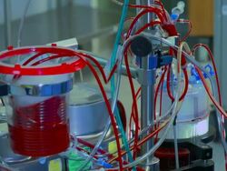 Surgery. Cardiopulmonary bypass machine Stock Footage