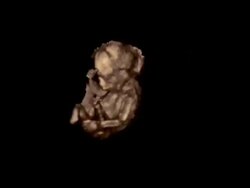 Foetus, rotating 3D ultrasound.. Stock Footage