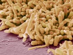 Plaque-forming bacteria, coloured scanning electron micrograph (SEM). Dental plaque is a biofilm of bacteria that forms on teeth. Stock Footage