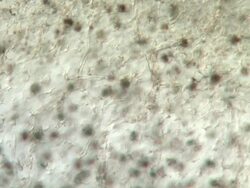 Blood cells moving through network of capillaries of tail of tadpole of Toad Bufo bufo Stock Footage