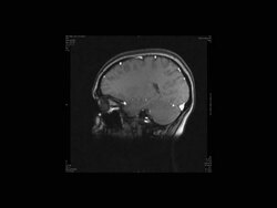 Human brain, magnetic resonance imaging (MRI) scan Stock Footage