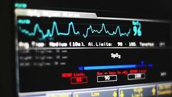 Pulse Oximeter Stock Footage