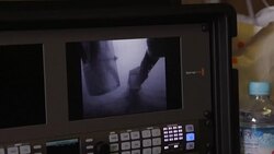 CLEAN : Nuclear water Fukushima still faces contamination crisis News Clip