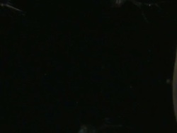 Endoscope view of Water fleas (Daphnia sp.) Sony PMW-EX3 Full HD video camera with endoscope, horizontal field of view is 3mm and slow motion at 60 fps. Stock Footage