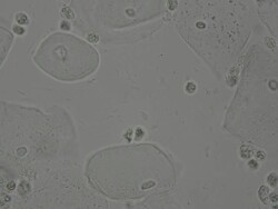 wet smear of vagina swab Stock Footage