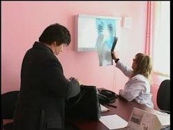 TB levels in Georgia among the worst in Eastern Europe News Clip