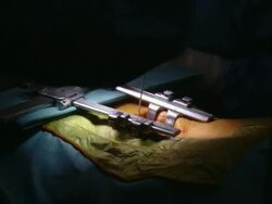 MS Surgery assistant helping surgeon / Cagliari, Sardinia, Italy Stock Footage