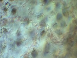 Capillaries of Toad tadpole tail.  Olympus S-Plan 20x objective, NFK 1.67x photoeyepiece. Stock Footage