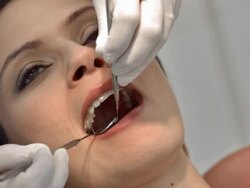 HD: Woman At The Dentist Stock Footage