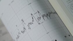Cardiotocography  exam of the pregnant woman Stock Footage