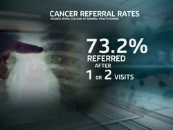 A Third of Cancer Patients Wait to be Referred News Clip
