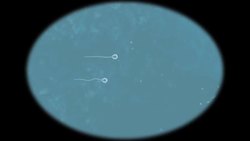 Vitamin D linked to health benefits Instructional Video