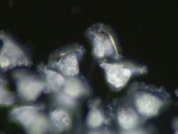 Dark Field view of the Ciliate Vorticella sp. filter feeding Stock Footage