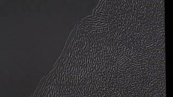 Polymer coating repels bacteria which cause hospital infections News Clip