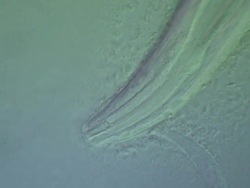 Caenorhabditis elegans wild type feeding on bacteria (E.coli OP50). Olympus BH-2 microscope, 60x S-Plan Apochromat objective, NFK .67 photoeyepiece, Differential Interference Contrast, horizontal field of view 200 microns. Stock Footage