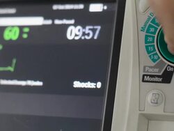 Defibrillator Stock Footage