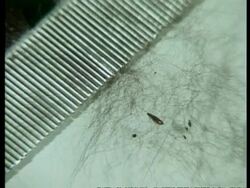 Flea amongst hair by comb, sequence, archive Stock Footage