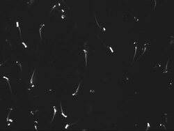 Microscopic footage of swimming sperm. Stock Footage