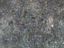 Human sperm, masses swimming around, medium wide pan Stock Footage