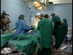 Surgeons successfully remove second head from baby News Clip