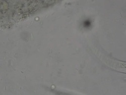 Parasite : Strongeroides stercolaris Stock Footage