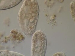Ciliate protozoa, Euplotes sp and Paramecium sp, recorded using Nomarski DIC sensitive grey setting. Stock Footage