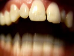 TEETH Stock Footage