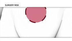 Women call for a ban on TVT mesh operation that can cause painful and disabling complications News Clip