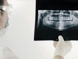 Dentist examining X-Ray image Stock Footage