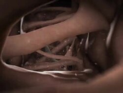 Extreme Close Up push-out - Parasitic worms attack a brain. Stock Footage