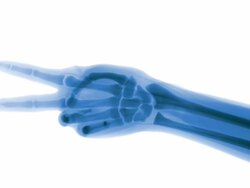 Blue X-ray hand plays rock-paper-scissors Stock Footage