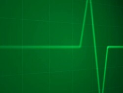 flatline EKG ECG taking puls v6.0 Stock Footage