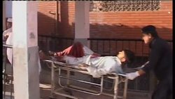 +GRAPHIC+ Wounded in hospital following blasts that killed at least 80 News Clip