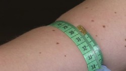 New technology - melting and freezing your way to beauty News Clip