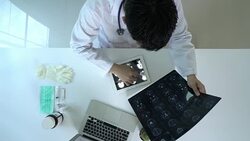 Doctor reading MRI film result Stock Footage