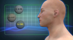 Iodine I131: effects on health and prevention with Iodine tablets Instructional Video