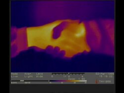 Thermographic imaging, CU hand shake Stock Footage