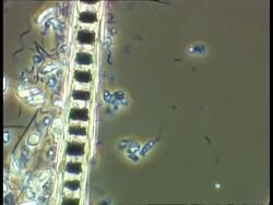 Track down filament of filamentous algae in pond sample.  Phase Contrast Stock Footage