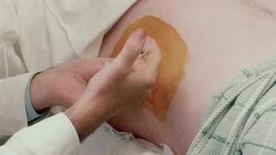 ZO Doctor injecting hypodermic needle into patient's side / United Kingdom Stock Footage