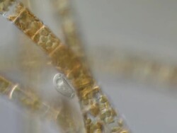 ECU TS Shot of Ciliates have specialized cilia that look and function like legs allowing them to crawl along algal filaments and flick up bacteria so that they can consume them / Newcastle Emlyn, Ceredigion, United Kingdom Stock Footage