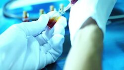 draws liquid medicine syringe and injects Stock Footage