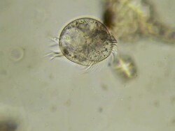 Ciliated microbe Stock Footage