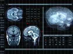 Brain MRT scan Stock Footage