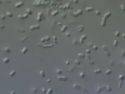 Friendly bacteria, Lactobacillus casei. A rod-shaped gram-positive, non-sporing, non-motile, obligate anaerobe, which inhabits human intestinal tracts. It is beneficial to human health eg improves and promotes digestion. Stock Footage