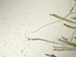 fungus spores Stock Footage