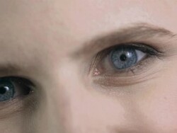 HD: Botox For Eyebrows Stock Footage