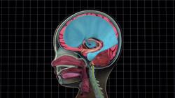 Baby girl successfully undergoes skull remodelling operation in India Instructional Video