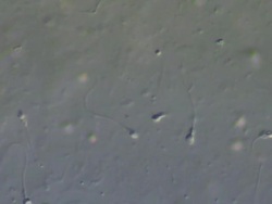 Human sperm, medium close up lots sperm swimming around Stock Footage